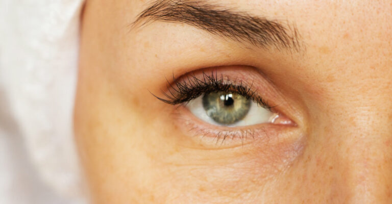 Eye Basics 101 – What Causes Puffy Eyes? | Eyelux Optometry